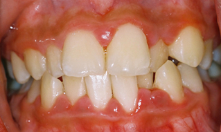 Ortodoncia/Rehabilitación Neuro-oclusal